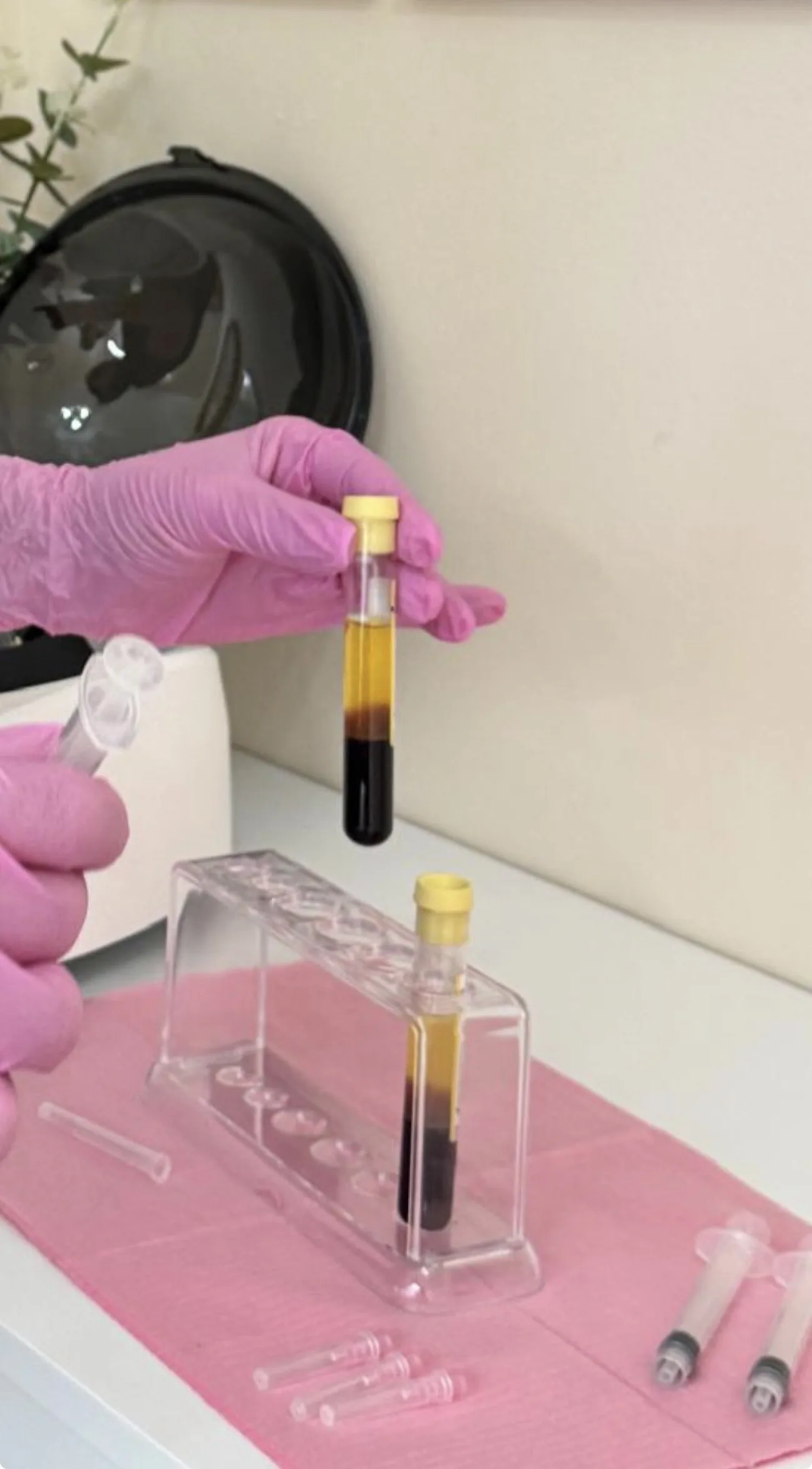 PRP preparation