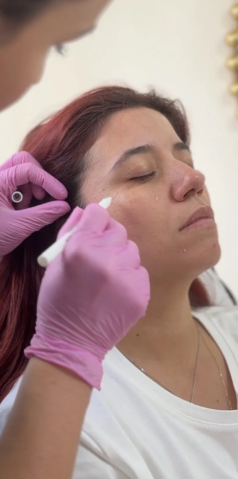 Skin rejuvenation
